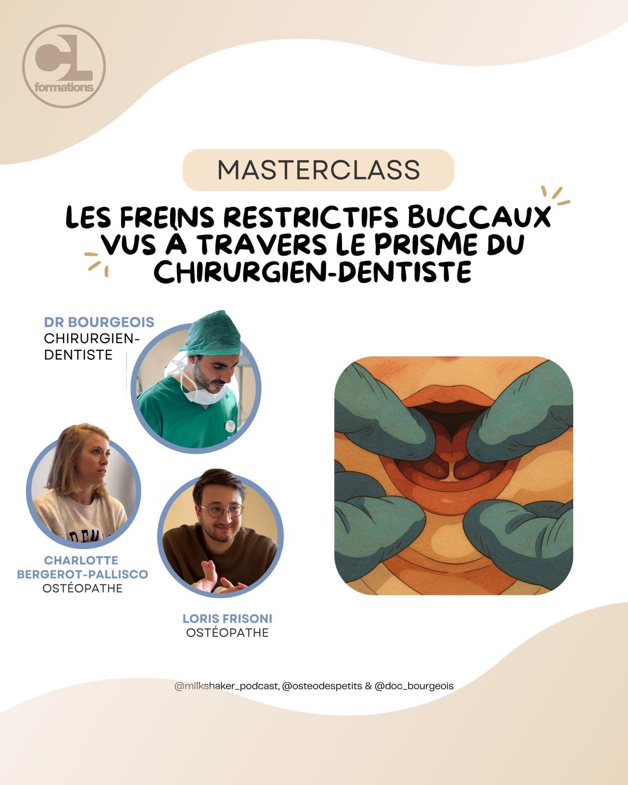 Les freins restrictifs buccaux vus à travers le prisme du chirurgien dentiste